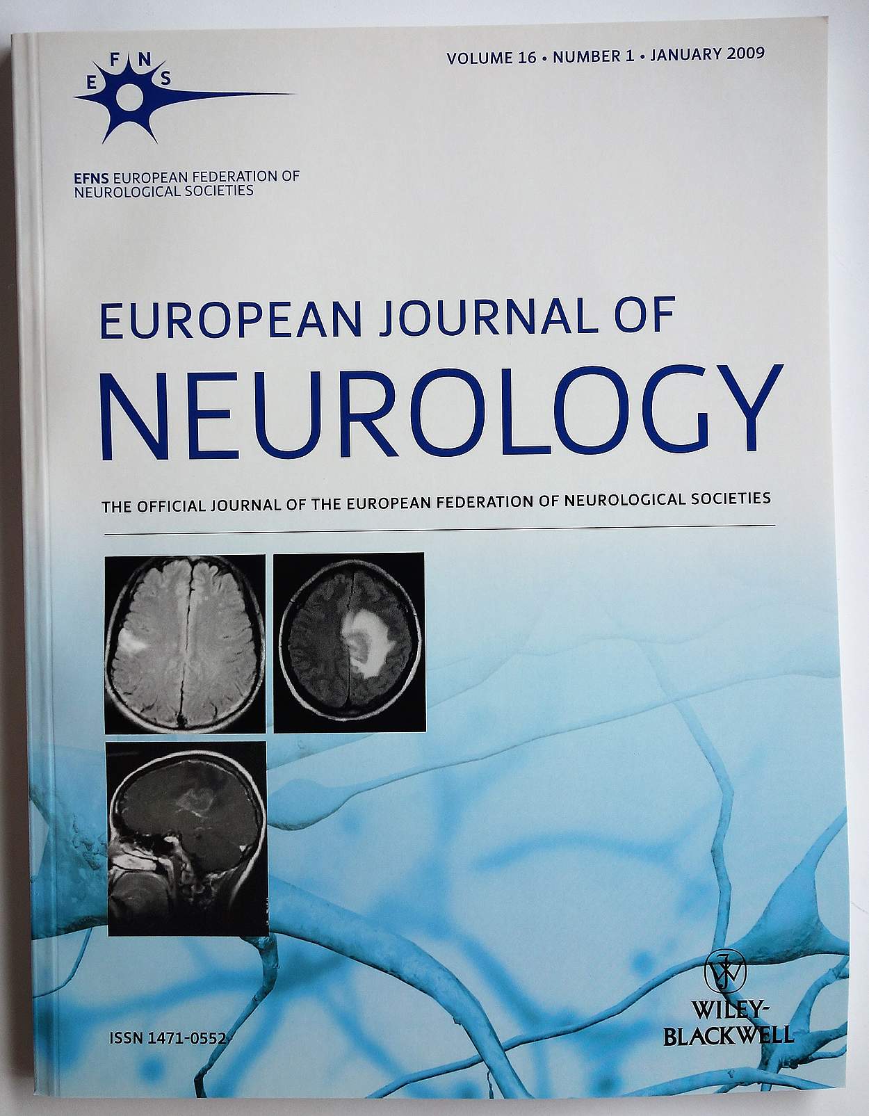 European Journal of Neurology - ean.org
